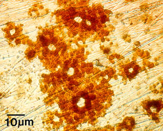 Microbially influenced pitting corrosion